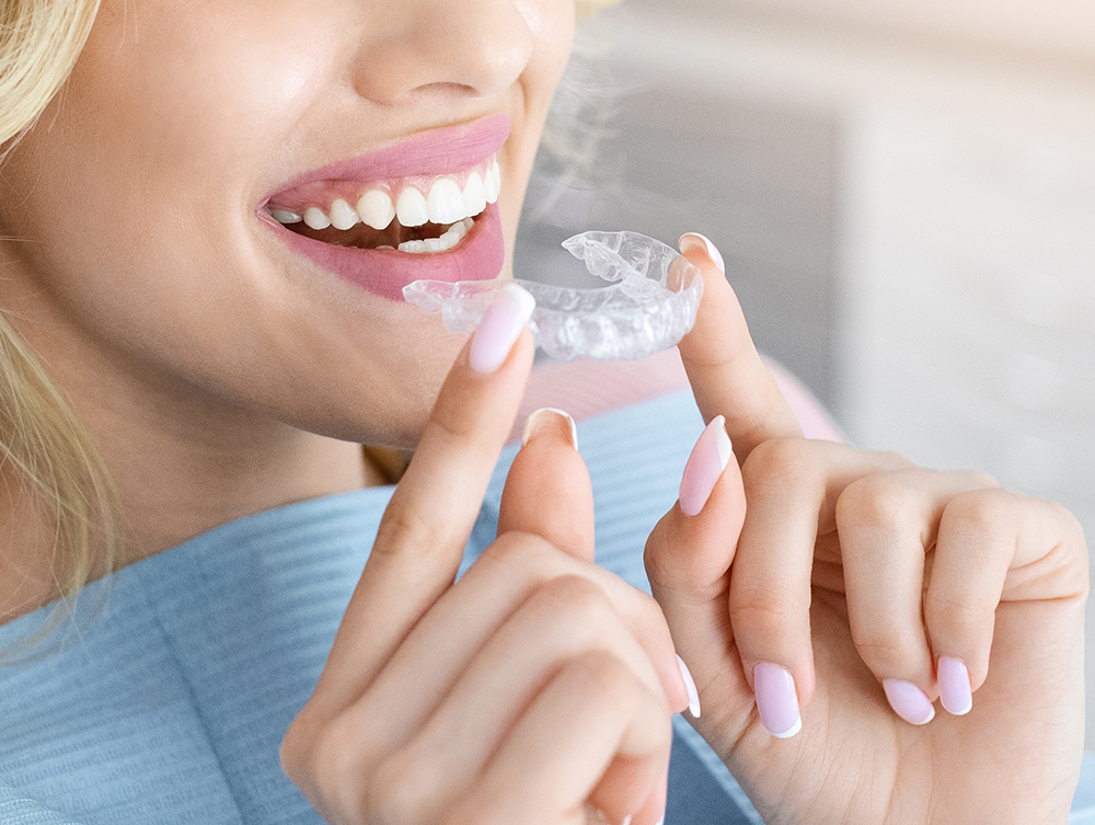 Invisalign Bremen – nahezu unsichtbare Zahnkorrektur Frau setzt eine Invisalign-Schiene in Bremen ein